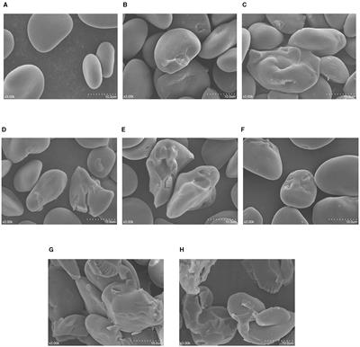 Comparative study: how dry heating treatment and annealing influence the multi-structure, physicochemical properties and in vitro digestibility of black highland barley starch